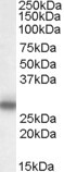 MPZ Antibody in Western Blot (WB)