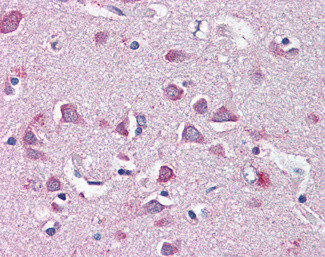 NF2 Antibody in Immunohistochemistry (Paraffin) (IHC (P))