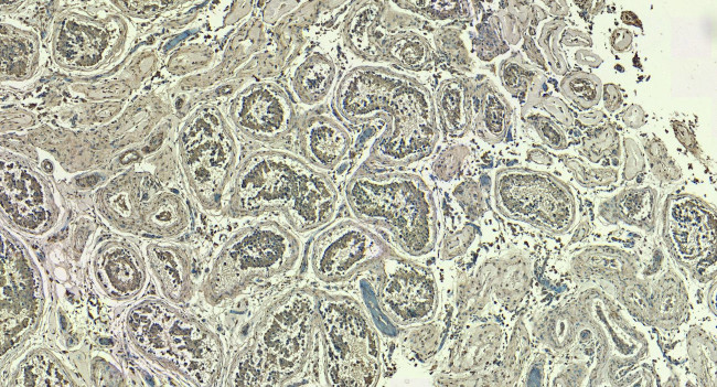 LDHC Antibody in Immunohistochemistry (Paraffin) (IHC (P))