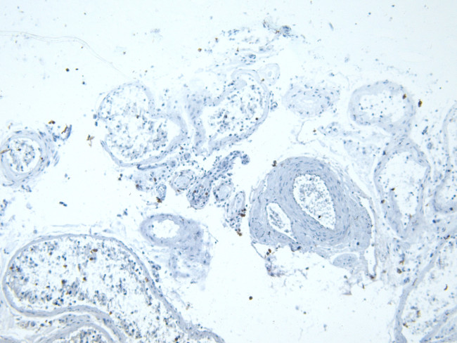 LDHC Antibody in Immunohistochemistry (Paraffin) (IHC (P))