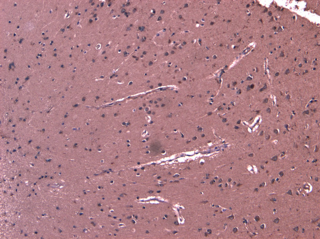 LGP2 Antibody in Immunohistochemistry (Paraffin) (IHC (P))