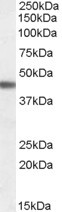 beta-3 Adrenergic Receptor Antibody in Western Blot (WB)