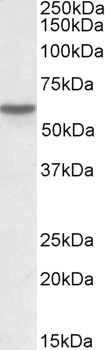 GC Antibody in Western Blot (WB)