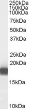 PLA2 Antibody in Western Blot (WB)