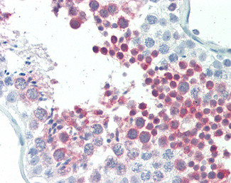 MEPCE Antibody in Immunohistochemistry (Paraffin) (IHC (P))