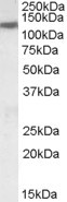 KCC3 Antibody in Western Blot (WB)