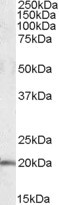 U2AF1L4 Antibody in Western Blot (WB)