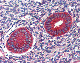 EPB41L2 Antibody in Immunohistochemistry (Paraffin) (IHC (P))