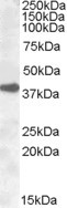 ERCC1 Antibody in Western Blot (WB)