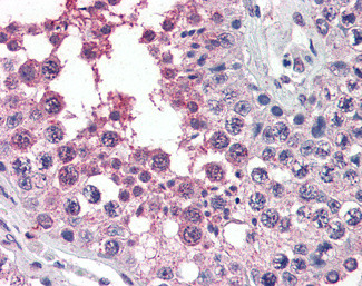 ACVR1 Antibody in Immunohistochemistry (Paraffin) (IHC (P))