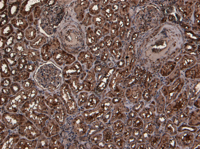 TMPRSS2 Antibody in Immunohistochemistry (Paraffin) (IHC (P))