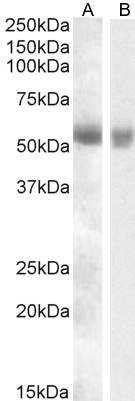 TMPRSS2 Antibody in Western Blot (WB)