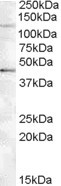 Tankyrase 2 Antibody in Western Blot (WB)