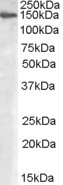 MAN2A1 Antibody in Western Blot (WB)