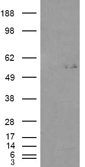 GCNT3 Antibody in Western Blot (WB)