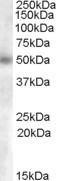 GCNT3 Antibody in Western Blot (WB)