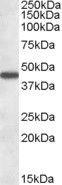 AADAT Antibody in Western Blot (WB)