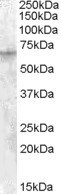 IGF2BP2 Antibody in Western Blot (WB)