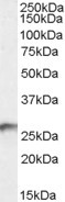 BDH2 Antibody in Western Blot (WB)