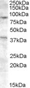 EXO1 Antibody in Western Blot (WB)