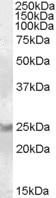 RAB8A Antibody in Western Blot (WB)