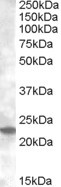 RAB17 Antibody in Western Blot (WB)