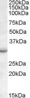 RAB23 Antibody in Western Blot (WB)