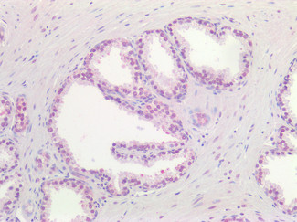 DNMT1 Antibody in Immunohistochemistry (Paraffin) (IHC (P))