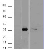 AKR1B10 Antibody in Western Blot (WB)