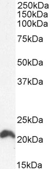 N-Ras Antibody in Western Blot (WB)