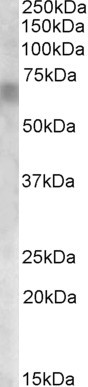 RPE65 Antibody in Western Blot (WB)