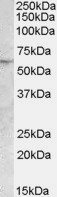 ATGL Antibody in Western Blot (WB)