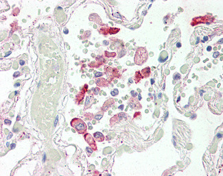 CES1 Antibody in Immunohistochemistry (Paraffin) (IHC (P))