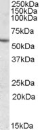 CES1 Antibody in Western Blot (WB)