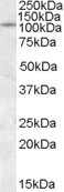 PTPRN Antibody in Western Blot (WB)