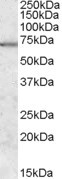 MARK2 Antibody in Western Blot (WB)