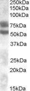 DACH1 Antibody in Western Blot (WB)