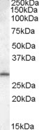 MTHFD2L Antibody in Western Blot (WB)