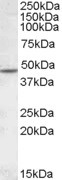 CHRNB2 Antibody in Western Blot (WB)