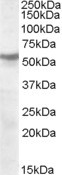 CHRNB1 Antibody in Western Blot (WB)