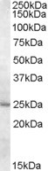 MTHFS Antibody in Western Blot (WB)