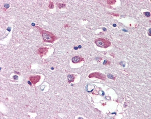 GluR4 Antibody in Immunohistochemistry (Paraffin) (IHC (P))