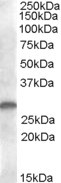 CLEC1B Antibody in Western Blot (WB)