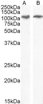 IRE1 alpha Antibody in Western Blot (WB)