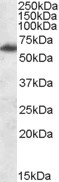 FTO Antibody in Western Blot (WB)