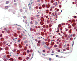 ABCA9 Antibody in Immunohistochemistry (Paraffin) (IHC (P))