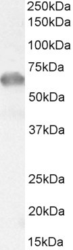 IRAK-M Antibody in Western Blot (WB)