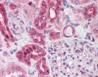 ABCD4 Antibody in Immunohistochemistry (Paraffin) (IHC (P))