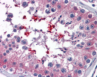 ABCD4 Antibody in Immunohistochemistry (Paraffin) (IHC (P))