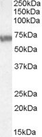 ABCD4 Antibody in Western Blot (WB)